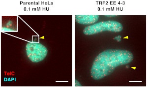 テロメア（染色体末端）構造安定性保持のための新たな分子メカニズムを解明