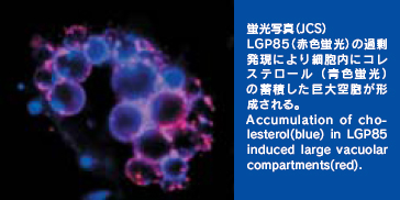 蛍光写真(JCS)　LGP85(赤色蛍光)の過剰発現により細胞内にコレステロール（青色蛍光）の蓄積した巨大空砲が形成される。Accumulation of cholesterol(blue) in LGP85 induced large vacuolar compartments(red).