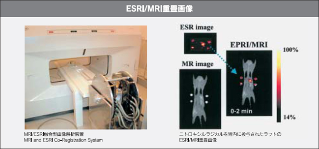 ESRI/MRI重畳画像