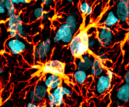 神経障害性疼痛の維持におけるグリア細胞活性化およびそのシグナル伝達経路を特定