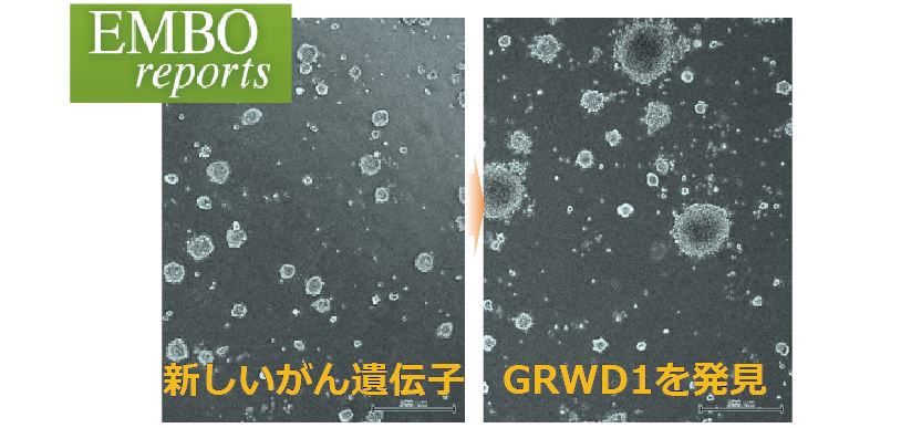 細胞をがん化させる新しいがん遺伝子GRWD1を発見！